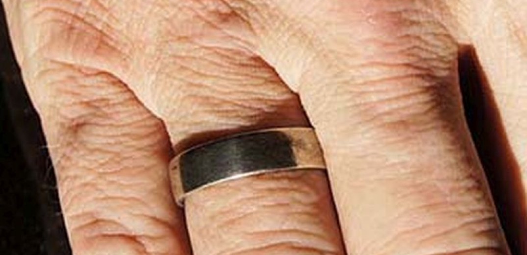 Χαλκιδική: Γιατροί φώναξαν ηλεκτρολόγο να τροχίσει δαχτυλίδι που σφήνωσε σε δάχτυλο ασθενούς