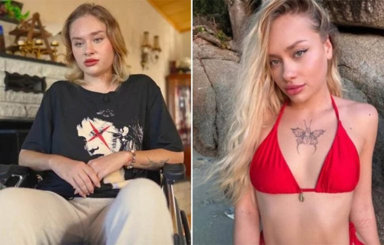 Πάρτι «porta potty»: Σε αμαξίδιο η Ουκρανή influencer – Της λείπουν 10 εκατοστά οστού από το πόδι