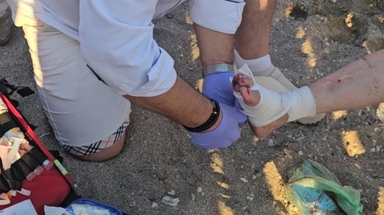 Σοκ σε παραλία της Αναβύσσου – Θαλάσσια χελώνα τραυμάτισε σοβαρά λουόμενη