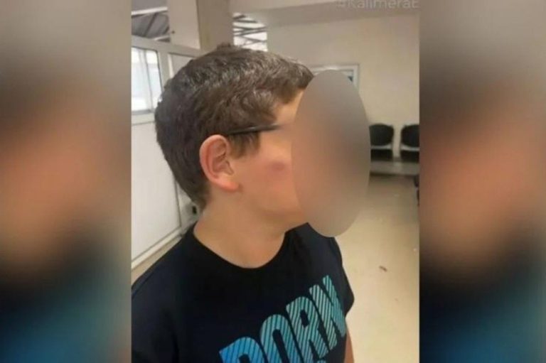 Θεσσαλονίκη: 11χρονος μαθητής ξυλοκοπήθηκε μέσα στο σχολείο του