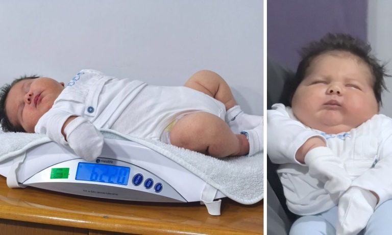 Απίστευτο! Μωρό 6 κιλών γεννήθηκε στην Τουρκία